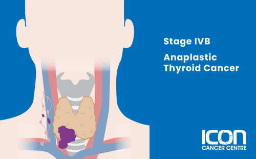 Stage IVB anaplastic thyroid cancer illustration